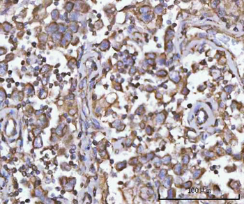Anti-PFKFB1 Antibody