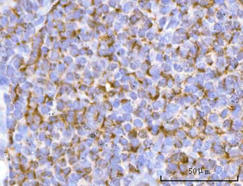 Anti-PFKFB1 Antibody