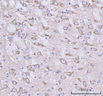 Anti-RPH3A Antibody