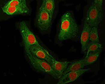 Anti-RFC4 Antibody