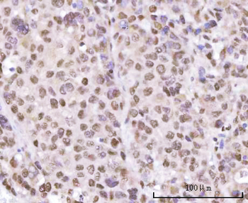 Anti-SF3A2 Antibody