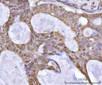 Anti-SF3A2 Antibody