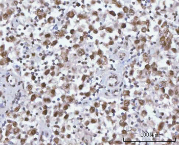 Anti-SF3A2 Antibody