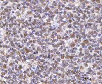 Anti-SF3A2 Antibody