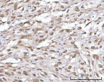 Anti-SF3A2 Antibody