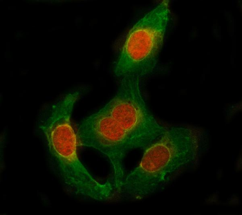 Anti-SESN1 Antibody