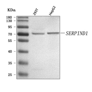 Anti-SERPIND1 Antibody