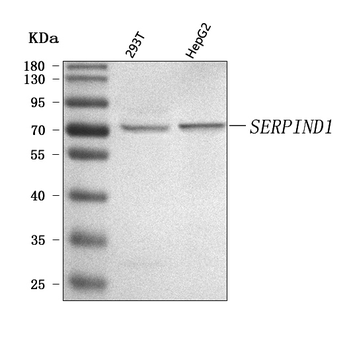 Anti-SERPIND1 Antibody