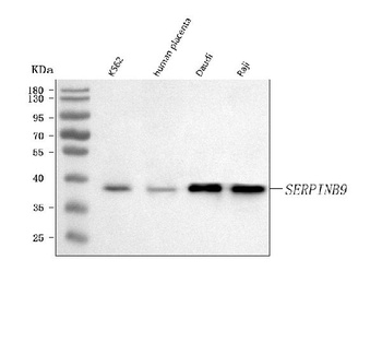 Anti-SERPINB9 Antibody