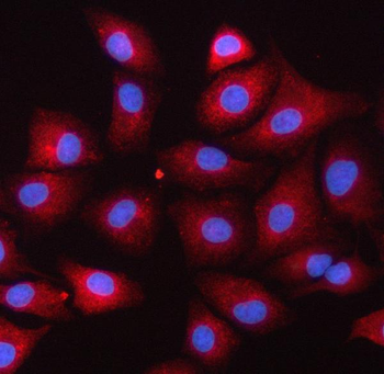 Anti-SERPINB9 Antibody