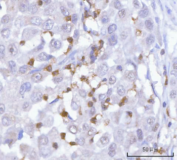 Anti-PRTN3 Antibody
