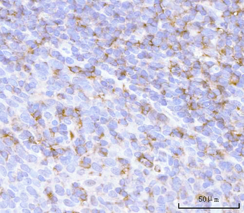 Anti-PRTN3 Antibody