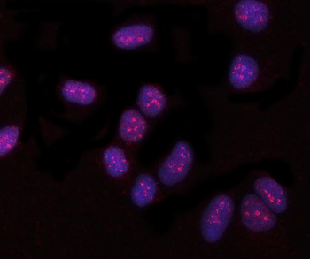 Anti-PYROXD1 Antibody