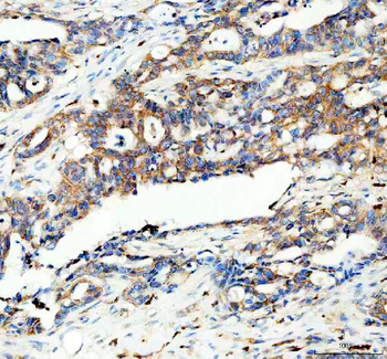 Anti-PYGL Antibody