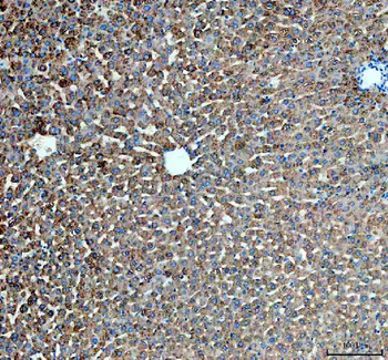 Anti-PYGL Antibody