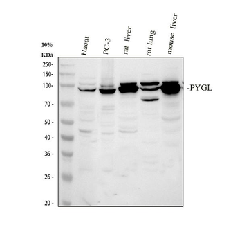 Anti-PYGL Antibody