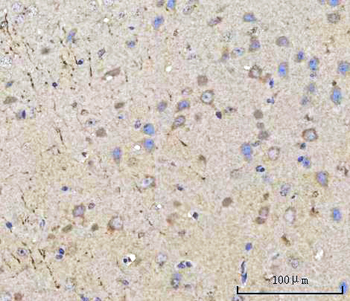 Anti-PPWD1 Antibody