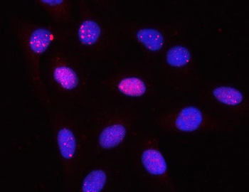 Anti-PPP2R3A Antibody