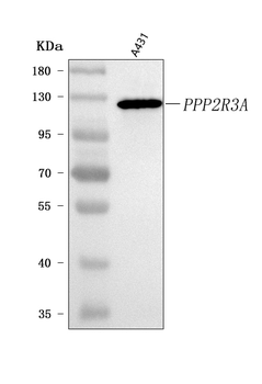 Anti-PPP2R3A Antibody