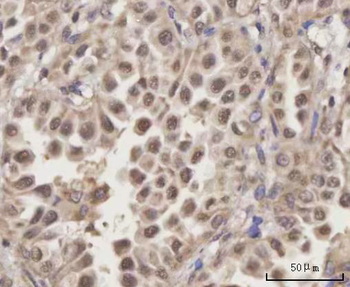 Anti-SCLY Antibody