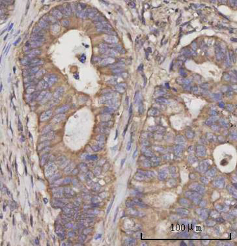 Anti-SCLY Antibody