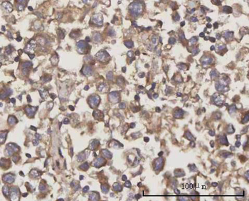 Anti-SCLY Antibody