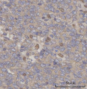 Anti-SCLY Antibody