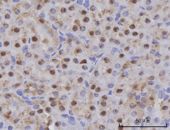 Anti-SCLY Antibody