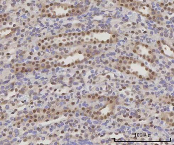 Anti-SCLY Antibody