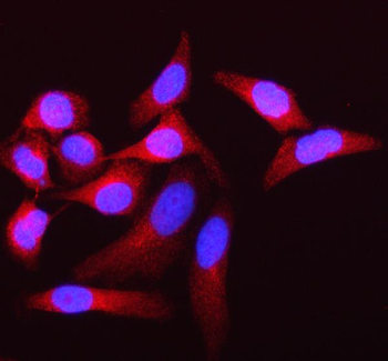 SAMD1 Rabbit Polyclonal Antibody