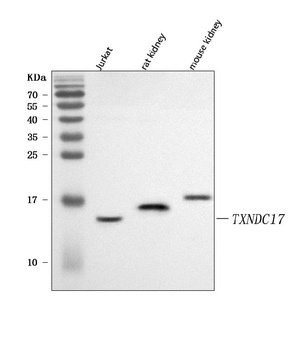 Anti-TXNDC17 Antibody