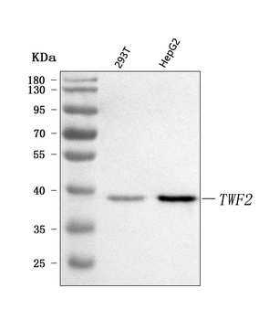 Anti-TWF2 Antibody