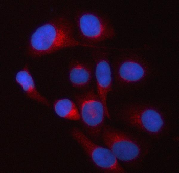 Anti-TWF2 Antibody