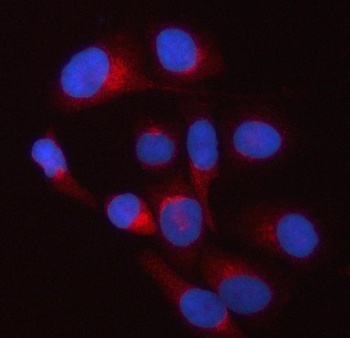 Anti-TWF2 Antibody