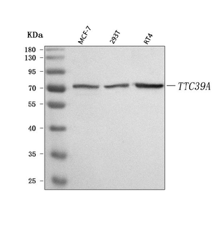 Anti-TTC39A Antibody