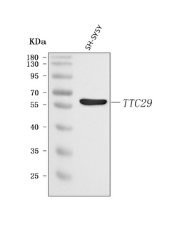 Anti-TTC29 Antibody