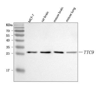 Anti-TTC9 Antibody