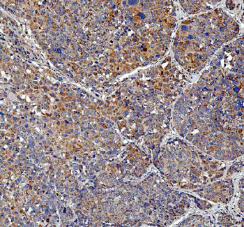 Anti-TRNT1 Antibody