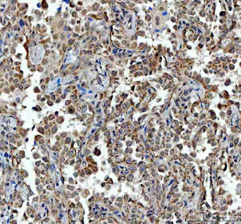 Anti-TRNT1 Antibody