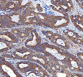Anti-TRNT1 Antibody