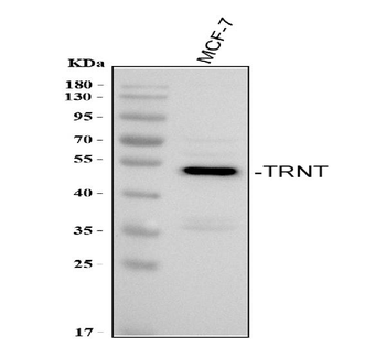Anti-TRNT1 Antibody