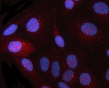 Anti-CEP164 Antibody