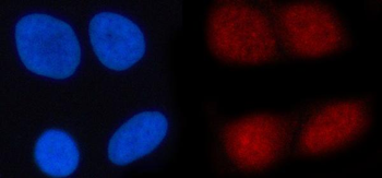 Anti-N4BP1 Antibody