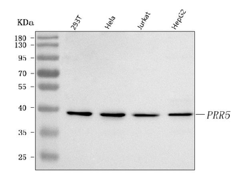 Anti-PRR5 Antibody