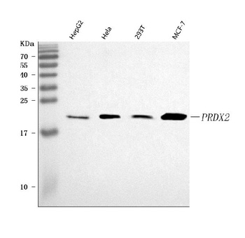Anti-peroxiredoxin 2/PRDX2 Antibody