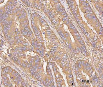 Anti-PPP3CB Antibody