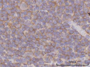 Anti-PPP3CB Antibody