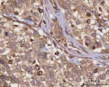 Anti-PPP3CB Antibody