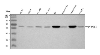 Anti-PPP3CB Antibody