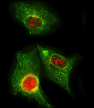 PPP2R5A Rabbit Polyclonal Antibody